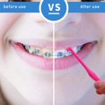 thumbnail image 4 of 8 Pcs Brosses à Dents Orthodontiques, Brosse Interdentaire Brosse à Dents pour Gencives Brosses pour Dents Souples Brosse à Touffes Dentaires Brosse Compacte pour Interstice Appareils Orthodontiques Brosse à Dents de Sagesse, 4 of 7