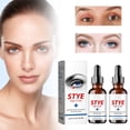 thumbnail image 2 of Stye Eye Treatment, Stye Eye Drops, Stye Treatment, Stye Relief Serum For Chalazions And Blepharitis, Eyelid Bumps, Non-Irritating Formula, Quickly Soothe Makeup Organizers, 2 of 9