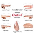 thumbnail image 2 of 3-Point Products Oval-8 Finger Splint Size 8 (Pack of 5), 2 of 4