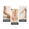 thumbnail image 3 of Electric Foot Grinder with Roller Head Battery Powered Portable Feet File Pedicure Tool Foot Scrubber, 3 of 8