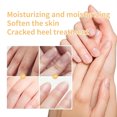 thumbnail image 4 of RKSTN Baume pour Enlever les Cuticules des Ongles Baume pour Enlever les Cuticules des Ongles Baume Exfoliant pour Ongles Baume de Réparation Vernis à Ongles 20g, 4 of 8