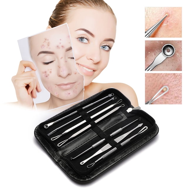 Blackhead and Comedone Extractor Kit Facial Pore Cleansing Tool with Stainless Steel Implements