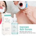 thumbnail image 3 of Serum for Ingrown Hairs, 30ml Razor Bumps Solution, Post-Hair Removal Repair Solution for Men Women, Reduce Redness & Dark Spots, 3 of 4
