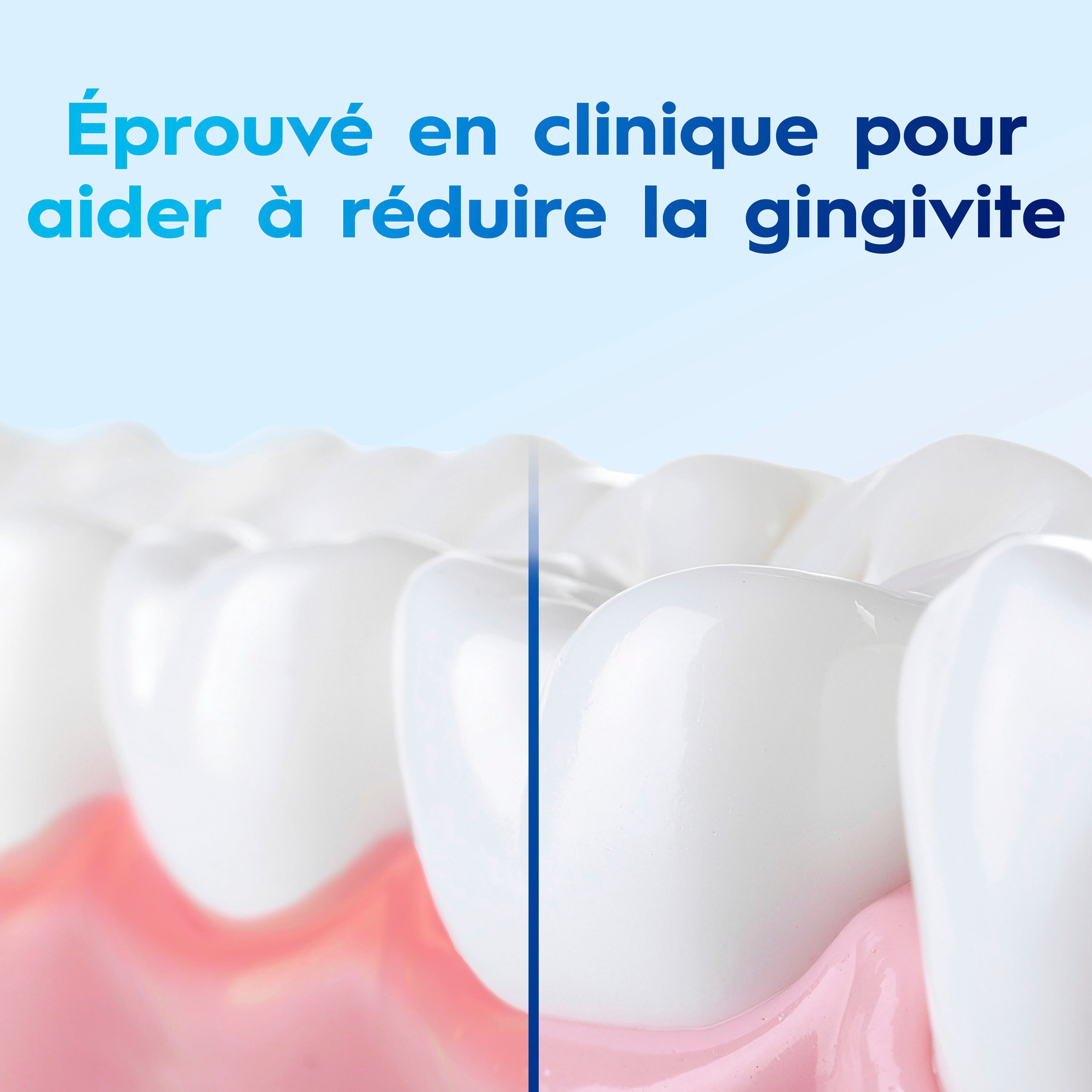 Rince-bouche Crest Pro-Santé Détoxification des gencives, antigingivite et antiplaque, neutralise la plaque, sans alcool, menthe d’hiver, 1 L
