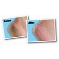 thumbnail image 2 of O'Keeffe's pour Healthy Feet Crème pour les Pieds - 3 Oz, 2 of 2