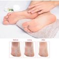 thumbnail image 5 of Dermave Éliminateur Électrique de Cal des Pieds, Éliminateur de Cal des Pieds Sans Douleur, Éliminateur de Cal des Pieds à Vitesse Réglable, Éliminateur de Cal des Pieds à Rotation 360 avec 60 Disques de Ponçage (Rose), 5 of 5