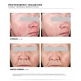 thumbnail image 3 of Skinceuticals Phyto Corrective Essence Mist - 1.7 oz, 3 of 4