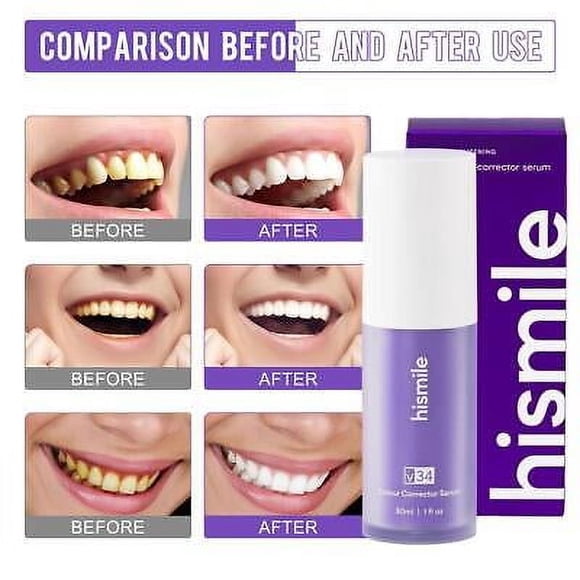 Hi smile v Correcteur de Couleur 34 Élimination des Taches sur les Dents Blanchiment des Dents Violet+