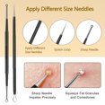 thumbnail image 3 of 10 Pcs Kit d'Outils pour Boutons en Acier Inoxydable Extracteur de Points Noirs Extracteur de Comédons pour Front Visage Nez Léger, 3 of 7