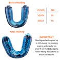thumbnail image 4 of Shock Doctor Gel Max Convertible Mouthguard, 4 of 5