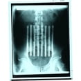 thumbnail image 2 of Mueller Sports Medicine Back Brace, White (Large), 2 of 2