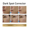 thumbnail image 4 of Clearance!Dark Remove For Face and Body: Advanced Dark Corrector For Age Sun Freckles Brown - Faded For Women - 30 ML, 4 of 7
