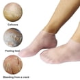 thumbnail image 2 of 1 Pair Moisturizing Socks High Elastic Non-slip SEBS Clear Foot Care Socks for Summer, 2 of 8