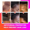 thumbnail image 3 of Moarie-Chebe Hair Spray, Moerie-Ultimate Minerals Hair Growth Set, 3 of 15