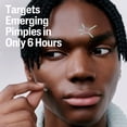 thumbnail image 3 of Fast Rescue Pimple Patches 24ct, 3 of 7