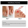 thumbnail image 3 of VONKY 10ml Ingrown Toenail Drops Fluid Soften Applying Straightening Essential Oil Portable Nail Repairing Essence Accessory, 3 of 5