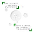 thumbnail image 3 of Vichy Normaderm Phytoaction Cleanser 400 Ml, 3 of 7