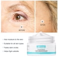 thumbnail image 3 of Crème pour les Yeux Anti-Rides, 2 Pcs Crème pour les Yeux Anti-âge à Réduction Rapide, Réduit Instantanément les Rides, les Poches Gonflées, les Poches sous les Yeux, Cernes en 5 Secondes, Hydrate et Soulève la Peau, 3 of 8