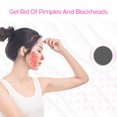 thumbnail image 4 of Portable Domestic Use Blackheads/Pimples/Old Cutin Remove Facial Maintenance Cosmetic Instrument, 4 of 8