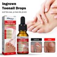 thumbnail image 5 of VONKY 10ml Ingrown Toenail Drops Fluid Soften Applying Straightening Essential Oil Portable Nail Repairing Essence Accessory, 5 of 5