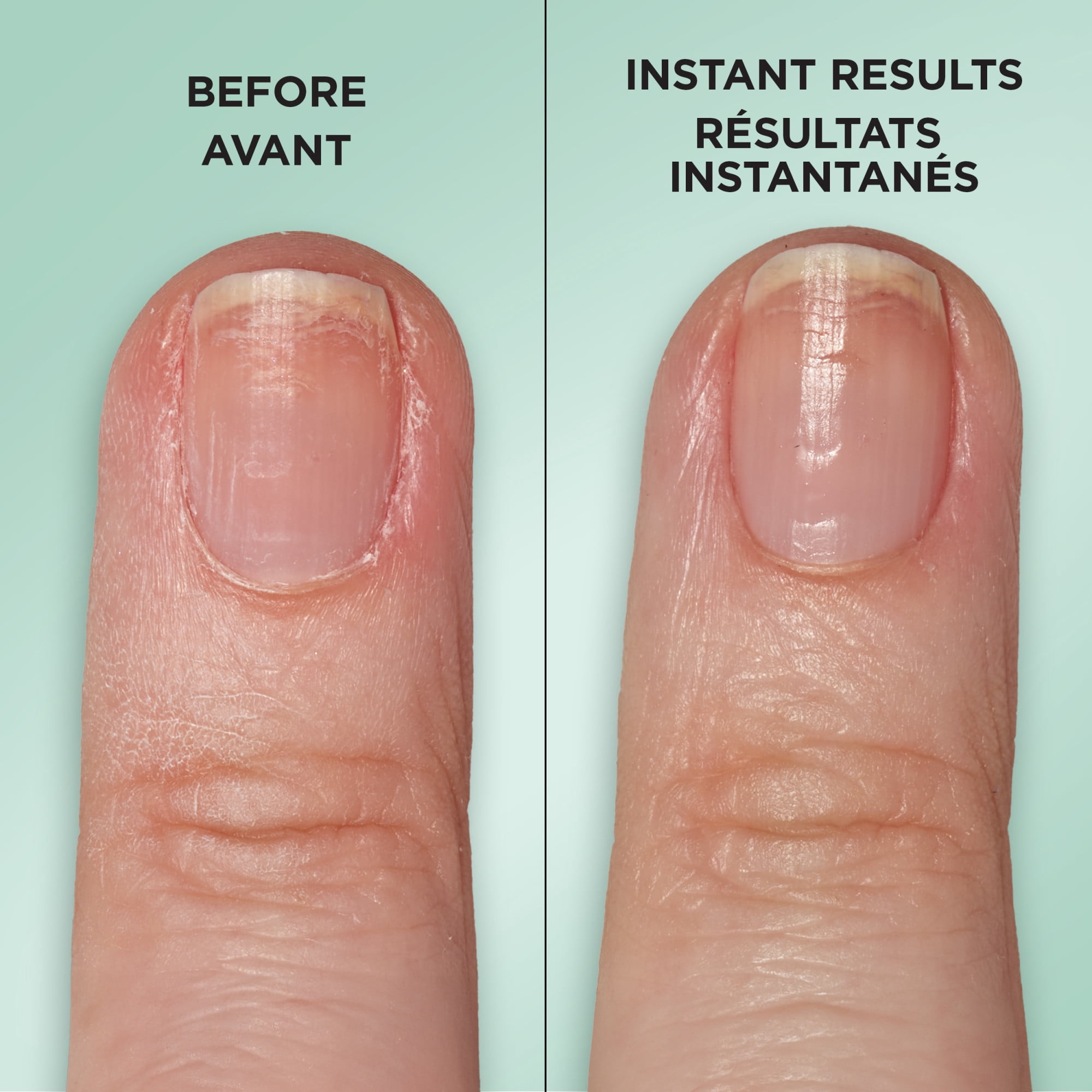 Sally Hansen Sérum de réparation d'ongles Gel Rehab, Soin des ongles, Vernis à ongles gel Réparation des dommages
