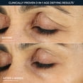 thumbnail image 4 of RoC Skincare - Retinol Correxion®️ - Line Smoothing Eye Cream (15ml), 4 of 12