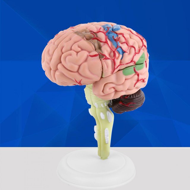 Cerveau Humain, 1 Pce Modèle Anatomique Démontable, Outil d'Enseignement pour Humain Facile à Transporter