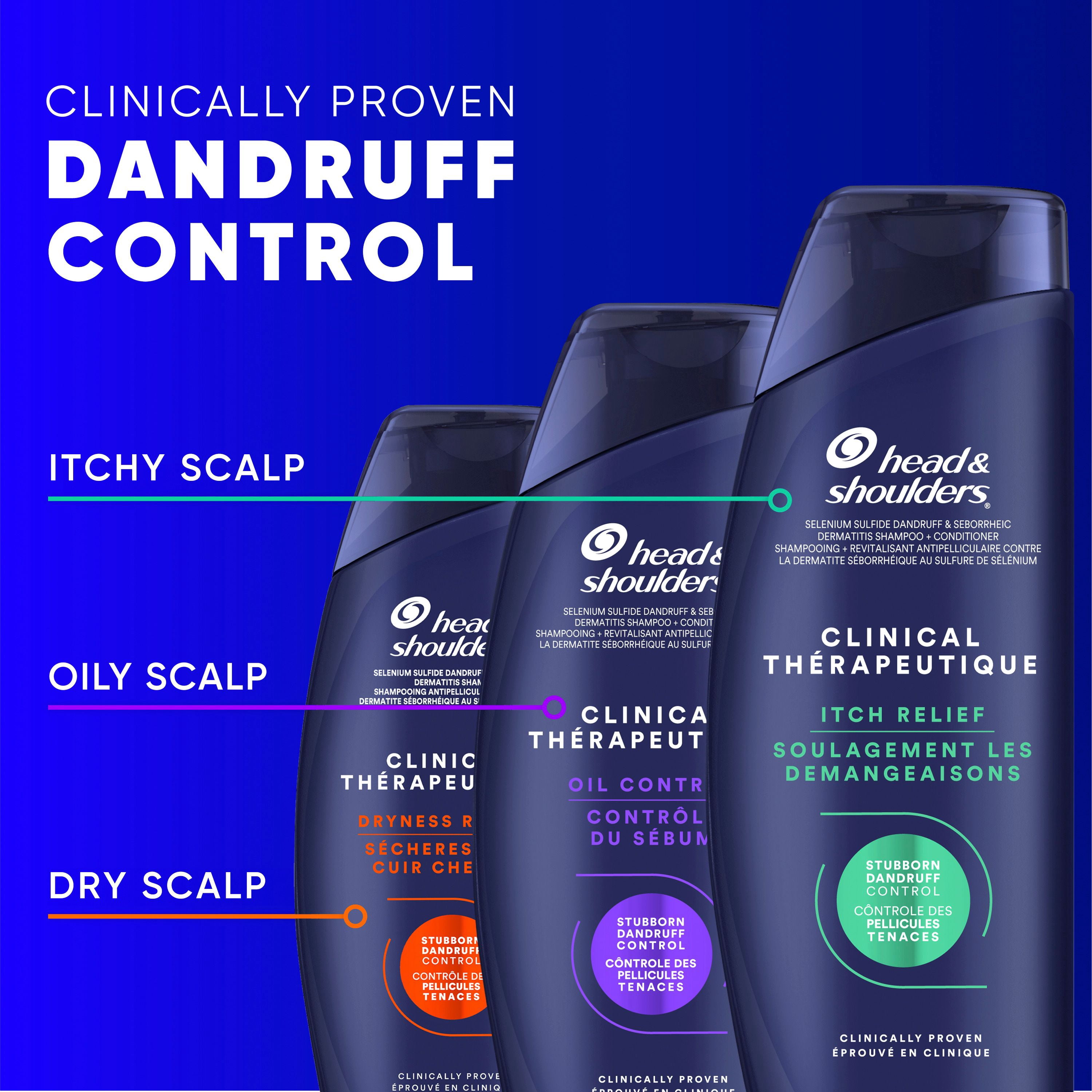 Head & Shoulders Clinical Dryness Rescue 2in1, for Stubborn Dandruff
