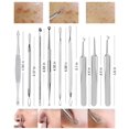thumbnail image 2 of Blackhead Extractor kit, Remover Acne Tool Professional Stainless Steel Comedone Extractor Instrument Tool Set for Curing Facial, 2 of 5