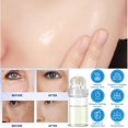thumbnail image 2 of USYFAKGH Micro Infusion System For Face 0.25mm/0.5mm Applicator Micro Infusion Facial System（5ml）, 2 of 4