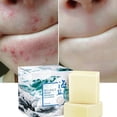 thumbnail image 3 of EIMELI Sea Sulfur Soap Bar by - Natural Face and Body Treatment Soap with Sulphur and Minerals from Sea Quickly Remove Mites Repair Nourish Skin, 3 of 12