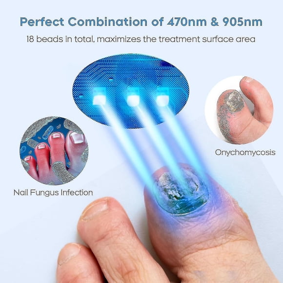 Nail Fungus Laser Treatment Device For Multiple Toenail, Home Use 905nm Infrared Light + 470nm Blue Light Toe Nail Fungus Device Jp