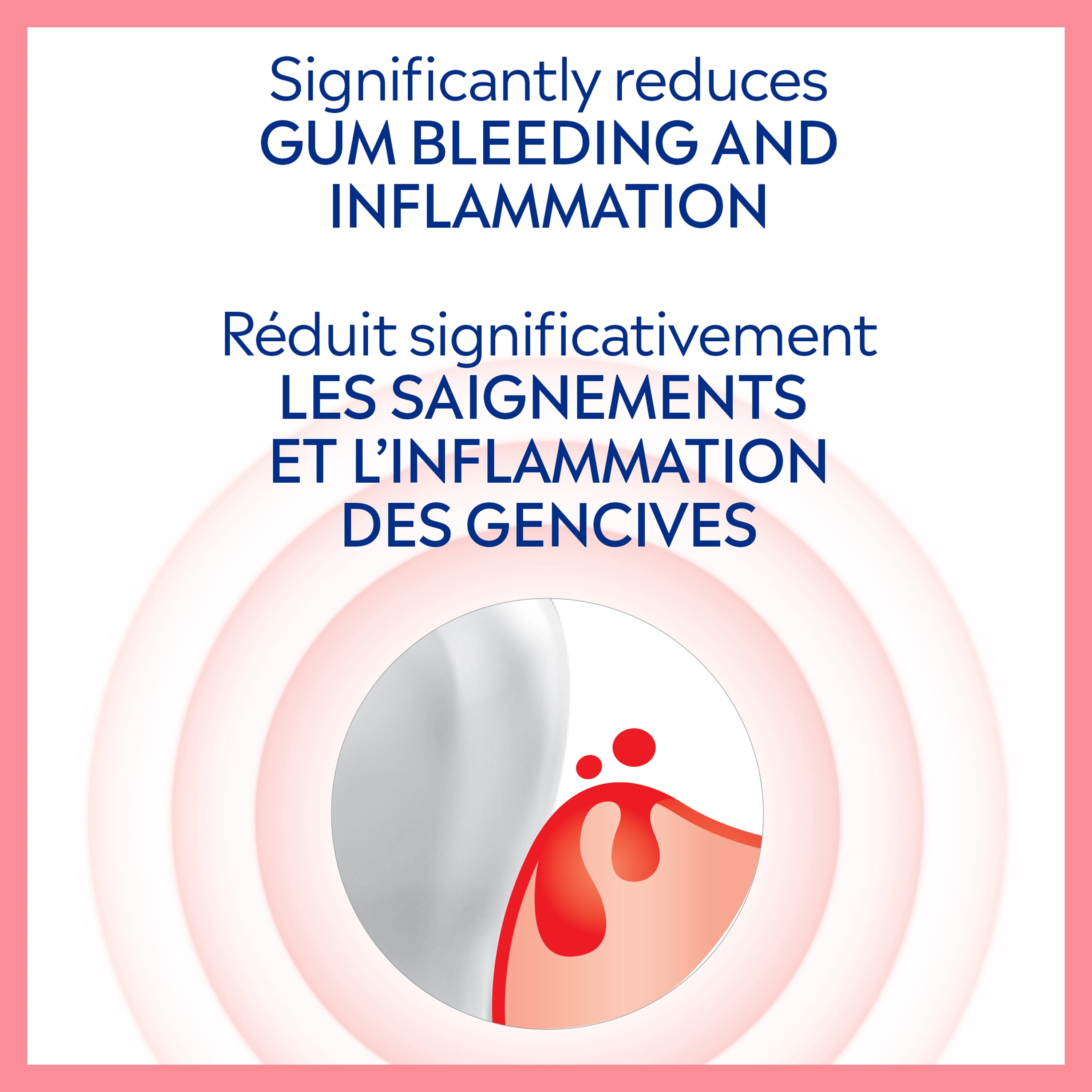 Colgate PerioGard SF Dentifrice pour Gencives, Dentifrice pour Soins des Gencives, 70 ml