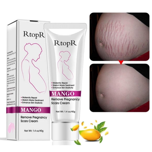 Crème Mangue pour Vergetures et Cicatrices, Crème pour Enlever les Vergetures et Cicatrices pendant la Grossesse, Crèmes pour Cicatrices et Cicatrices au Ventre contre les Rides