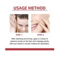 thumbnail image 5 of Sérum Anti-Imperfections Niacinamide 10 % + TXA 4 % (30 ml), 5 of 5