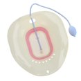 thumbnail image 4 of Foldable sitz bath sitz bath bidet sitz bath bidet insert for toilet WC, with Pink-2, 4 of 8