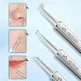 thumbnail image 3 of Classicous Blackhead Remover Tools, Stainless Steel Blackhead Remover Kit, Facial Blackhead Remover Tweezers, 14 in 1 Comedone Extractor Tools Set with Portable Case (5pcs), 3 of 9