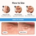 thumbnail image 4 of Hero Cosmetics Mighty Patch Invisible, Barely-there Hydrocolloid Patches for Pimples on The Face for Daytime Use, Sensitive Skin, 48 Count, 4 of 6