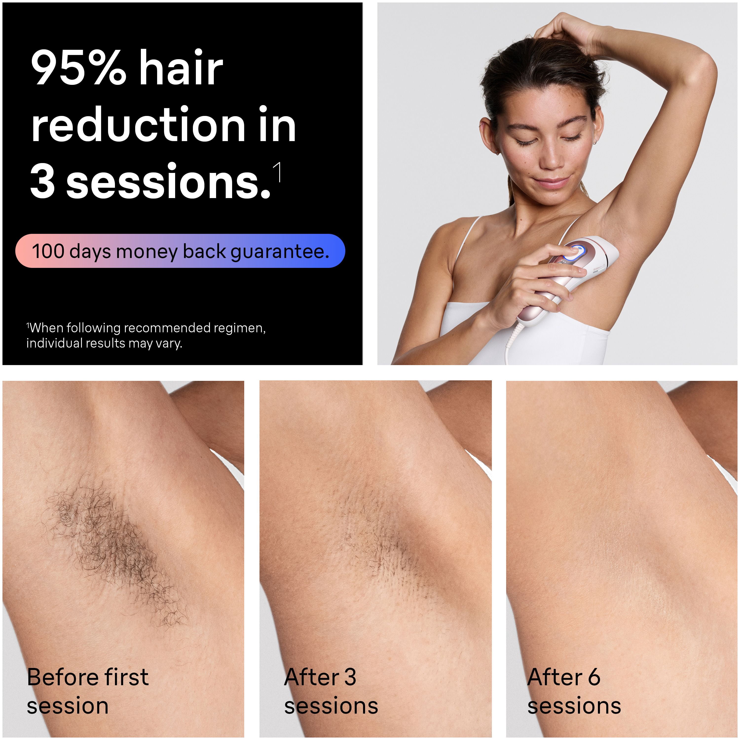 Système d’épilation à domicile Braun Peau i-expert, technologie LIP intelligente, PL7243, pour femmes et hommes, avec application, avec étui haut de gamme, 3 têtes, rasoir Venus