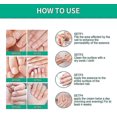 thumbnail image 5 of New Slinx Kerassentials Toenail Fungus Treatment Oil, Kerassentials For Toenail Fungus, 5 of 5