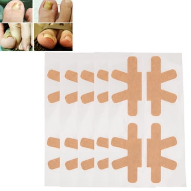 Autocollant pour Ongles Incarnés, Patch de Correction des Ongles, Ne Tombe Pas Facilement, Soulagement de la Douleur à la Maison