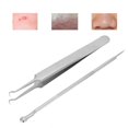 thumbnail image 4 of Kit d'Extraction, Outil de Retrait de Points Noirs, Ensemble d'Outils de Retrait de Boutons, Extracteurs de Boutons à Double Extrémité en Acier Inoxydable Facile à Utiliser Durable avec Étui de Rangement, 4 of 8