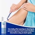 thumbnail image 2 of PFB Vanish Razor Bump Stopper Roll-On With Chromabright – Ingrown Hair & Dark Spot Treatment, Razor Burn Relief For Bikini, Legs, Face & Neck, 3.3 fl oz, 2 of 6