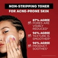 thumbnail image 3 of Thayers 2% SA Salicylic Acid Toner, 3 of 5
