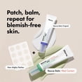 thumbnail image 2 of Hero Rescue Balm Post-Blemish Cream, Moisturizing & Soothes Dry, Sensitive Skin, Hydrating Formula, Dermatologist Tested, 15ml, 2 of 7
