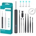thumbnail image 1 of Ear Wax Removal Kit Wifi With Camera, Visible Spoon For Ear Cleaning, 1080p Hd Otoscope Tool With Usb Load, 1 of 5