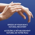 thumbnail image 3 of Vaseline Healing Jelly Original, 50 g, 3 of 8