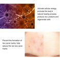 thumbnail image 3 of Skin Eraser Powerful Pen Red Blud Machine Therapy Pimple  Skin Care Repairing Instrument For  Scar Removal Improve Skin Elasticity, 3 of 8