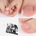 thumbnail image 3 of 10 Pcs Correcteur d'Ongle Incarné Professionnel avec Boîte, 3 of 10