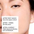 thumbnail image 2 of Vichy Normaderm Phytoaction Cleanser 400 Ml, 2 of 7